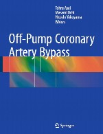 Off-Pump بای پس عروق کرونرOff-Pump Coronary Artery Bypass