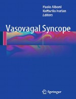 سنکوپ وازوواگالVasovagal Syncope