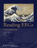 خواندن EEG ها – رویکرد عملیReading EEGs
