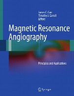 آنژیوگرافی با تشدید مغناطیسی – اصول و کاربرد هاMagnetic Resonance Angiography