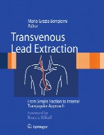 استخراج سرپوش ترانس وریدی – از انقباض ساده تا رویکرد ترانس ژوگولار داخلیTransvenous Lead Extraction