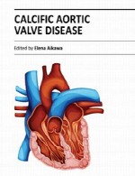 بیماری دریچه آئورت CalcificCalcific Aortic Valve Disease