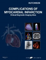 عوارض سکته قلبیComplications of Myocardial Infarction