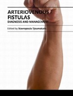 فیستول های شریانی – تشخیص و مدیریتArteriovenous Fistulas