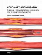آنژیوگرافی (رگ نگاری) عروق کرونر – نیاز به بهبود در درمان پزشکیCoronary Angiography