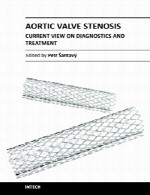 تنگی دریچه آئورت – دیدگاه فعلی در تشخیص و درمانAortic Valve Stenosis-Current View on Diagnostics and Treatment