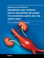 تشخیص و درمان آنوریسم (اتساع عروق) آئورت شکمی و قفسه سینهDiagnosis and Treatment of Abdominal and Thoracic Aortic Aneurysms