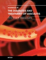 پیشرفت ها در تشخیص و درمان واسکولیت (التهاب رگ)Advances in the Diagnosis and Treatment of Vasculitis