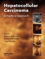کارسینوم هپاتوسلولار – رویکرد عملیHepatocellular Carcinoma