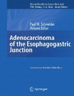 آدنوکارسینوم تقاطع معده - مری (ایسوفاگوگاستریک)Adenocarcinoma of the Esophagogastric Junction