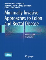 رویکردهای کم تهاجمی برای بیماری روده بزرگ و مقعد – تکنیک و بهترین روش هاMinimally Invasive Approaches to Colon and Rectal Disease