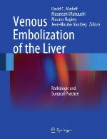 آمبولیزاسیون وریدی کبد – عمل رادیولوژیک و جراحیVenous Embolization of the Liver