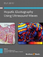الاستوگرافی کبدی با استفاده از امواج اولتراسوندHepatic Elastography Using Ultrasound Waves