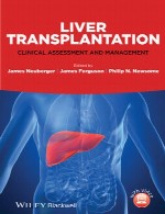 پیوند کبد – ارزیابی و مدیریت بالینیLiver Transplantation