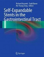 استنت های قابل انبساط در دستگاه گوارشSelf-Expandable Stents in the Gastrointestinal Tract