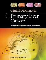 معماهای بالینی در سرطان اولیه کبدClinical Dilemmas in Primary Liver Cancer