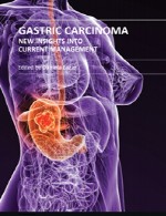 سرطان معده – بینش های جدید به مدیریت کنونیGastric Carcinoma