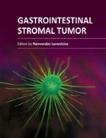 تومور استرومال (بافت همبند) دستگاه گوارشGastrointestinal Stromal Tumor