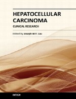 کارسینوم هپاتوسلولار (سرطان سلول کبدی) – پژوهش بالینیHepatocellular Carcinoma
