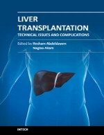 پیوند کبد – مسائل فنی و عوارضLiver Transplantation