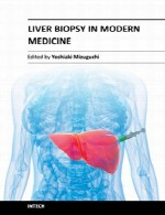 بیوپسی (برداشت بافت) کبد در طب مدرنLiver Biopsy in Modern Medicine