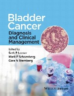 سرطان مثانه - تشخیص و مدیریت بالینیBladder cancer