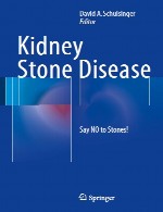 بیماری سنگ کلیه – نه گفتن به سنگ...!Kidney Stone Disease