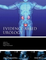 اورولوژی مبتنی بر شواهدEvidence-based Urology