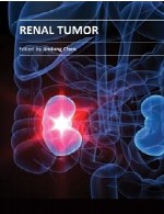 تومور کلیویRenal Tumor