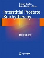 براکی تراپی بینابینی پروستات - LDR-PDR-HDRInterstitial Prostate Brachytherapy