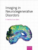 تصویربرداری در اختلالات نورودژنراتیو (تخریب کننده عصب)Imaging in Neurodegenerative Disorders