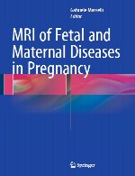 MRI جنین و بیماری های مادر در دوران بارداریMRI of Fetal and Maternal Diseases in Pregnancy