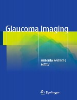 تصویربرداری گلوکومGlaucoma Imaging