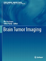 تصویربرداری تومور مغزیBrain Tumor Imaging