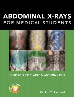 اشعه های X شکمی - برای دانشجویان پزشکیAbdominal X-rays - for Medical Students
