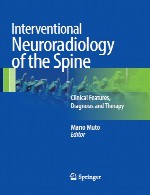 رادیولوژی عصبی مداخله ای – ویژگی های بالینی، تشخیص و درمانInterventional Neuroradiolog