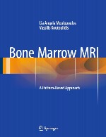 MRI مغز استخوان – رویکرد مبتنی بر الگوBone Marrow MRI