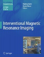 تصویربرداری رزونانس مغناطیسی مداخله ایInterventional Magnetic Resonance Imaging