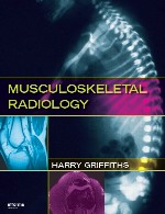 رادیولوژی اسکلتی عضلانیMusculoskeletal Radiology