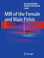 MRI از لگن زن و مردMRI of the Female and Male Pelvis
