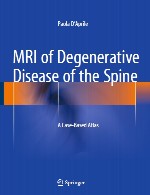 MRI از بیماری دژنراتیو ستون فقرات – اطلس مبتنی بر موردMRI of Degenerative Disease of the Spine