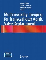 تصویربرداری مولتی مودالیتی برای جایگزینی ترانس کاتتر دریچه آئورتMultimodality Imaging for Transcatheter Aortic Valve Replacement