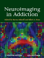 تصویربرداری عصبی در اعتیادNeuroimaging in Addiction
