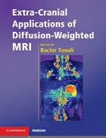 کاربرد های فوق العاده کرانیال MRI دیفیوژن-وزنیExtra-Cranial Applications of Diffusion- Wrighted MRI