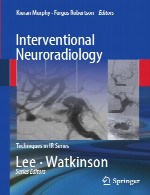نورورادیولوژی (رادیولوژی مغز و اعصاب) مداخله ایInterventional Neuroradiology