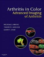 آرتروز (آرتریت) در رنگ – تصویربرداری پیشرفته آرتروزArthritis in Color