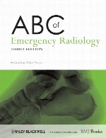 ABC رادیولوژی اورژانسABC of Emergency Radiology