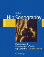 سونوگرافی مفصل ران (لگن) – تشخیص و مدیریت دیسپلازی مفصل ران نوزادHip Sonography