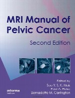 راهنمای ام آر آی (MRI) سرطان لگنMRI Manual of Pelvic Cancer