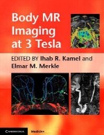تصویربرداری MR بدن در 3 تسلاBody MR Imaging at 3 Tesla